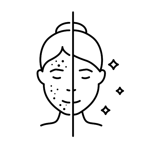 درمان ترکیبی جای جوش